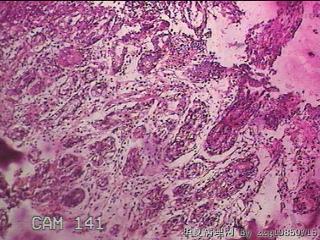 胃窦后壁粘膜图17