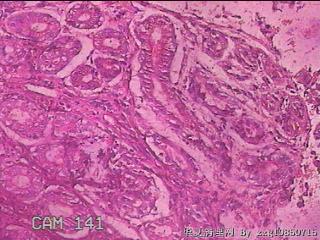 胃窦前壁粘膜图37