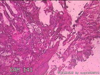 胃窦前壁粘膜图35