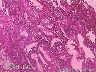 胃窦前壁粘膜图33