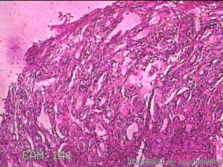 胃窦前壁粘膜图19