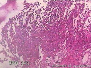 胃窦后壁粘膜图19