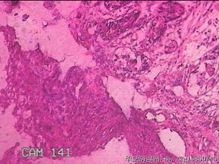 胃窦后壁粘膜图32