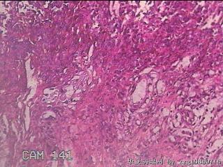 胃窦后壁粘膜图48