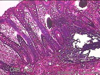 横结肠粘膜图4