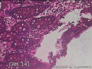 横结肠粘膜图14