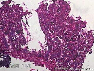 横结肠粘膜图9