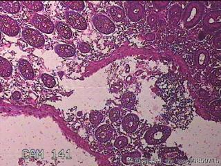 横结肠粘膜图3