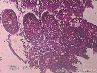 横结肠粘膜图24