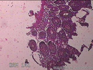 横结肠粘膜图7