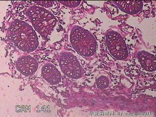 横结肠粘膜图20