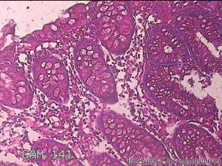 横结肠粘膜图18