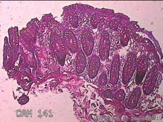 横结肠粘膜图1