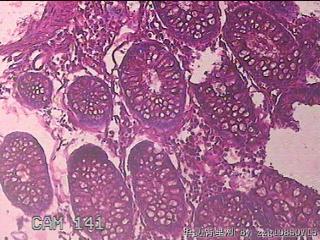 横结肠粘膜图23