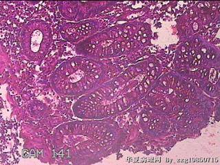 横结肠粘膜图11