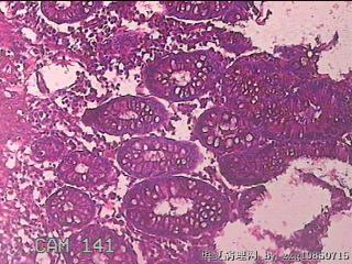 横结肠粘膜图22