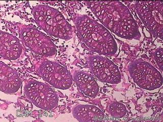 横结肠粘膜图17