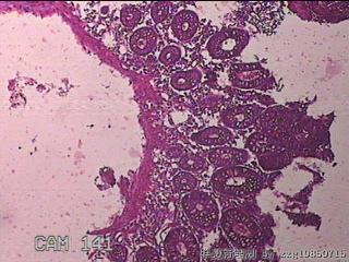 横结肠粘膜图6