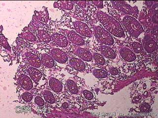 横结肠粘膜图2
