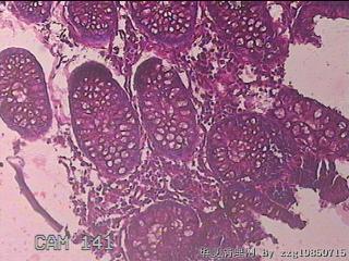 横结肠粘膜图8