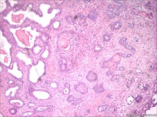 前列腺组织图38