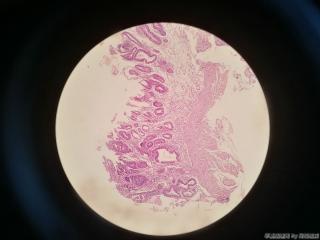 胃窦前壁粘膜图3