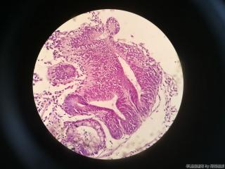胃窦前壁粘膜图20