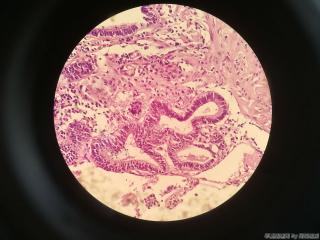 胃窦前壁粘膜图10