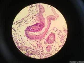 胃窦前壁粘膜图21