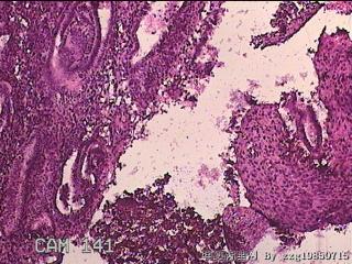 子宫内膜图18