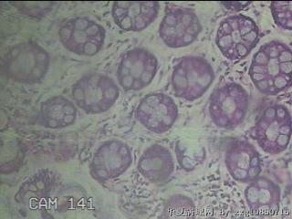 直肠粘膜图53