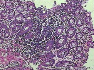 直肠粘膜图30