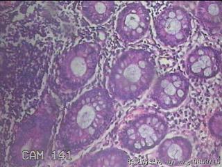 直肠粘膜图41