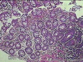直肠粘膜图32