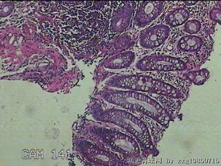 直肠粘膜图31