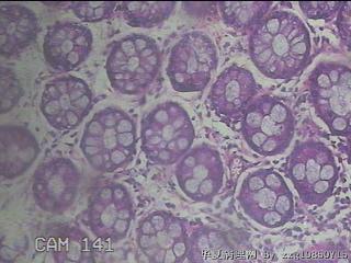 直肠粘膜图23