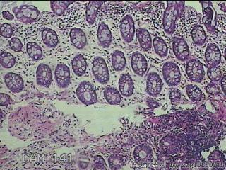直肠粘膜图34