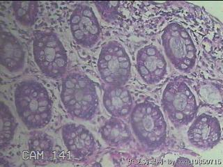 直肠粘膜图39