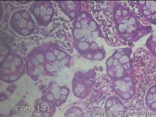 直肠粘膜图48