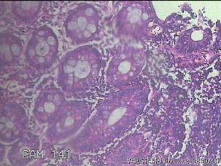 直肠粘膜图45