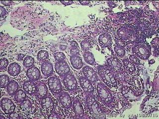 直肠粘膜图33