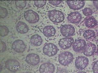 直肠粘膜图52