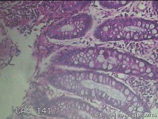 直肠粘膜图42