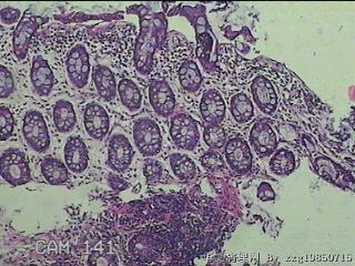 直肠粘膜图28