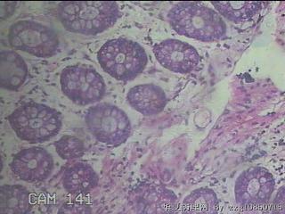 直肠粘膜图51