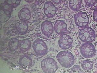 直肠粘膜图49