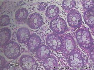 直肠粘膜图47