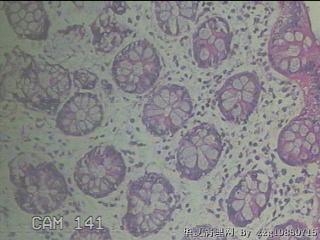 降乙结肠粘膜图10