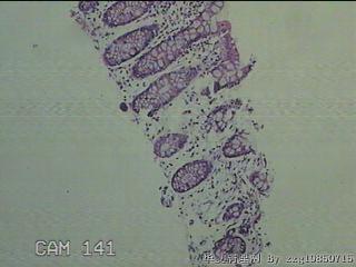 降乙结肠粘膜图5
