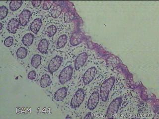 降乙结肠粘膜图8